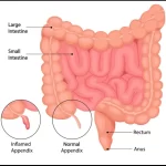 Appendix