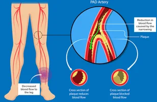 vascular-6