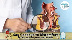 Anal Fissure & Fistula : Symptoms, Causes, and Modern Treatment Methods